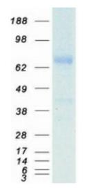 SDS-PAGE (TF-393HFL).jpg